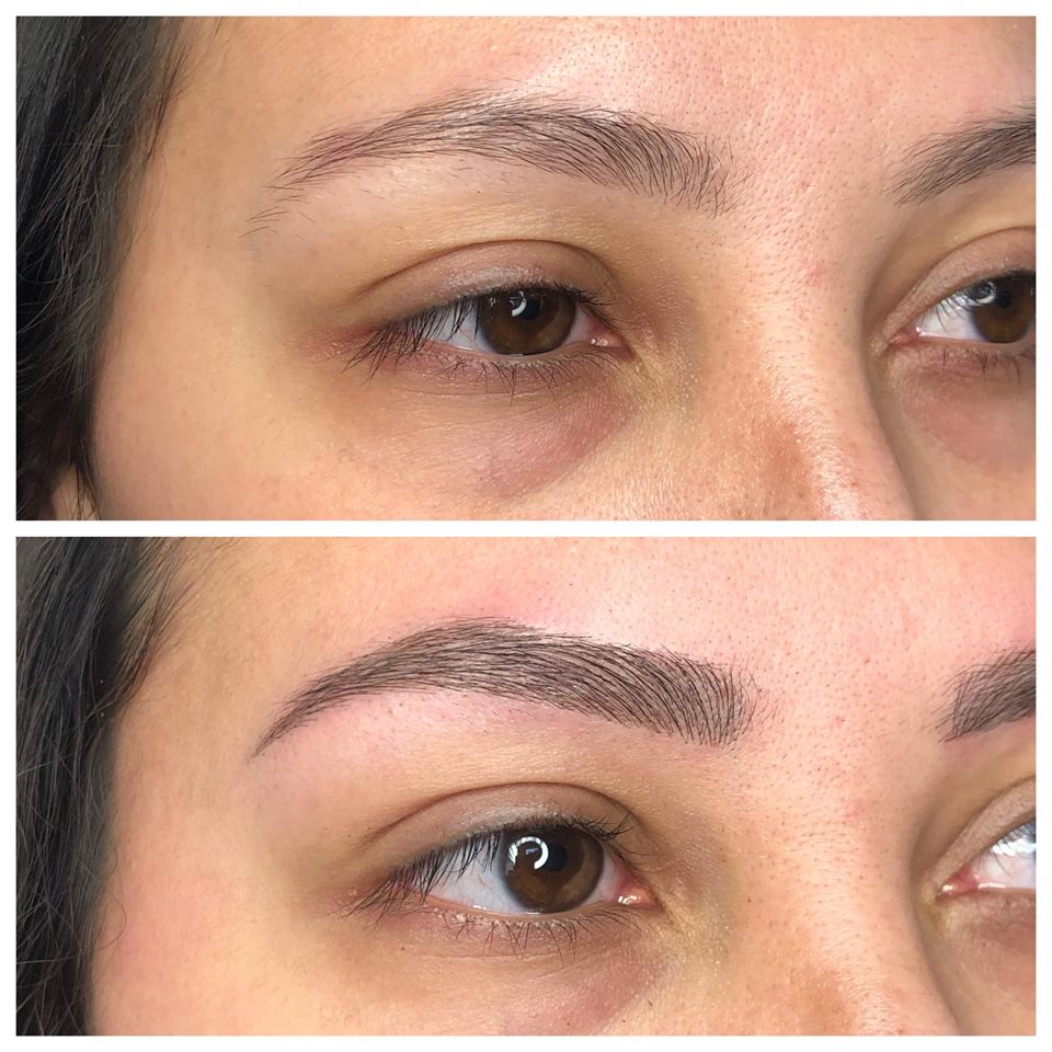 میکروبلیدینگ در رشت