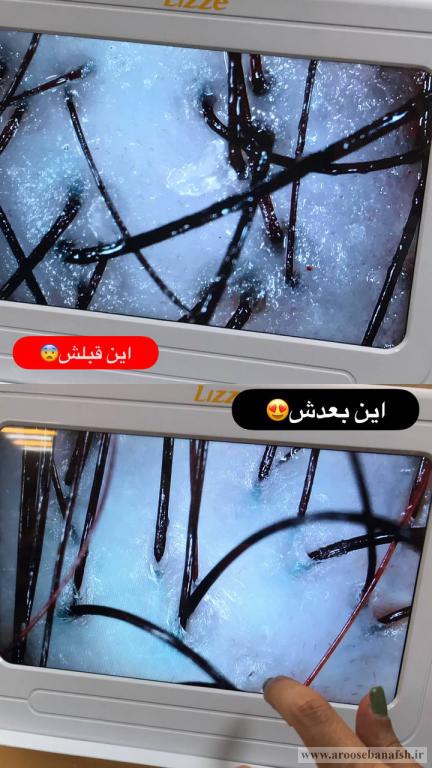 اسکراپ اسکالپ