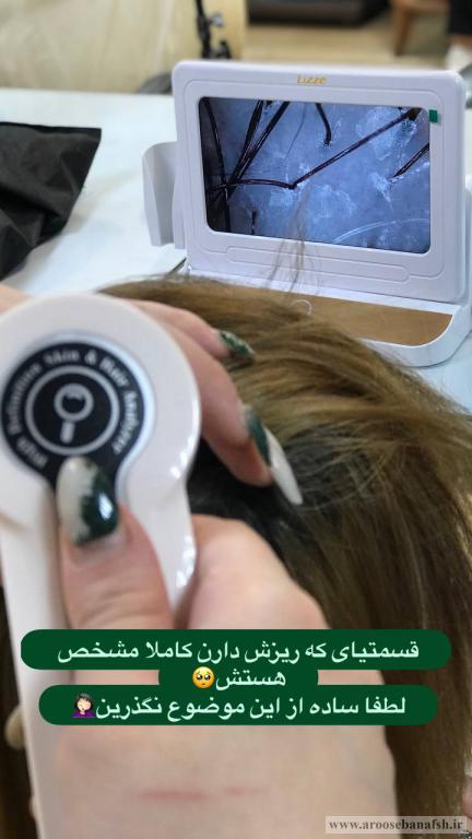 اسکراپ اسکالپ در رشت