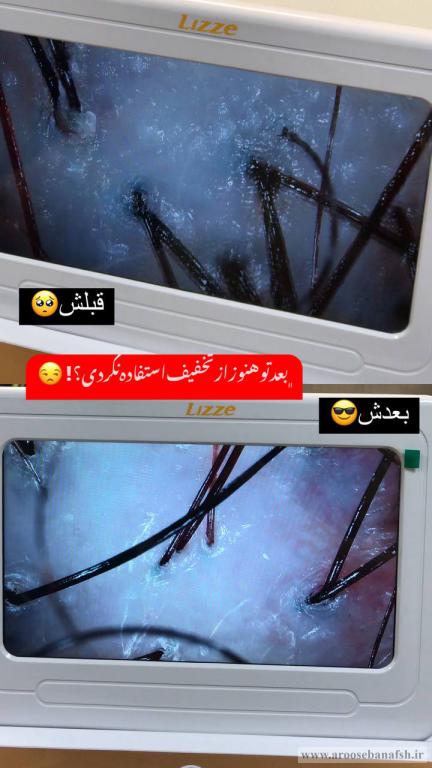 پاکسازی کف سر